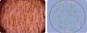 After Treatment Diagram